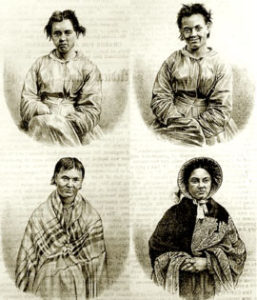 Puerperal Mania in Four Stages, 1858